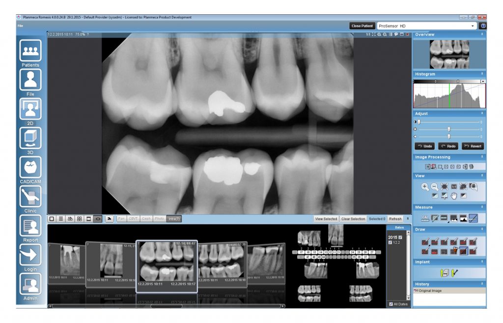 Planmeca ProSensor H